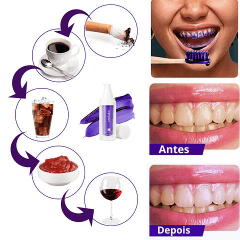 Pasta Clareadora Smilekit V34 - Nova Fórmula Instantânea